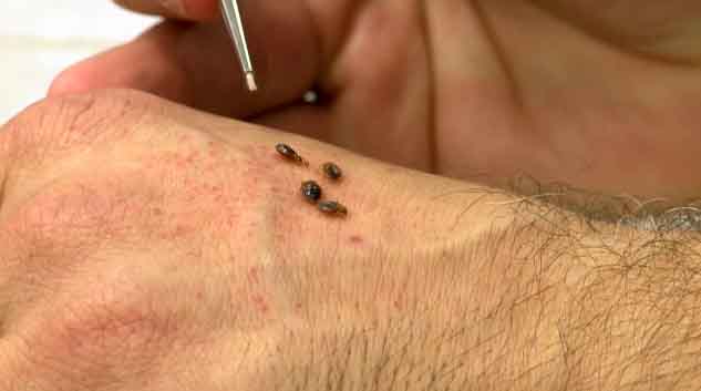 Bed Bug Service - Truly Nolen Pest Control Bed Bugs-On-Skin